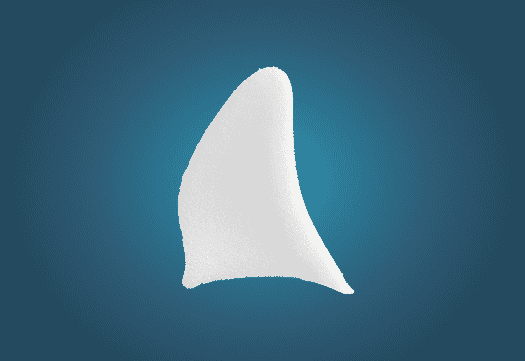 White porous polyethylene implant showing curved anatomical shape on blue background
