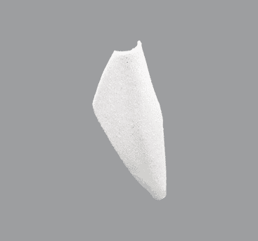 White curved shell-shaped implant for nasal bridge reconstruction
