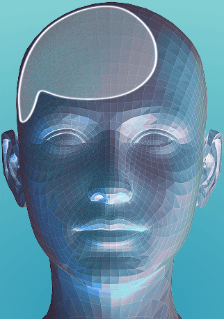 Porous polyethylene implants cranial reconstruction 3D model showing SU-POR surgical technology